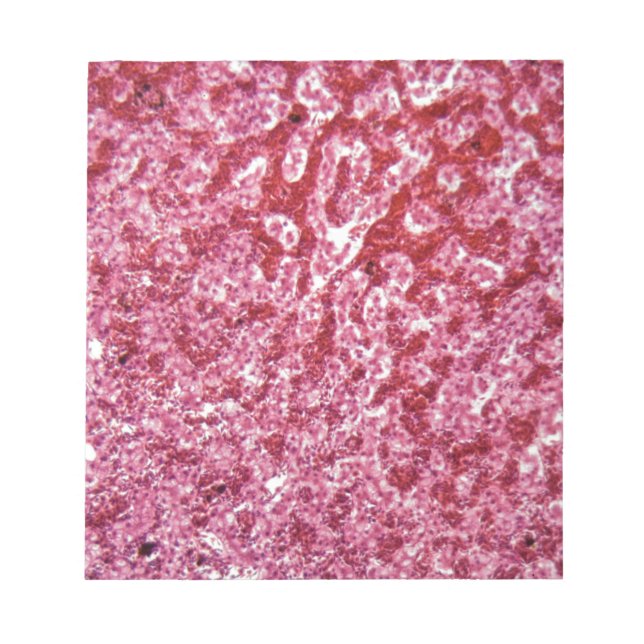 Bloco De Notas Células hepáticas humanas com cancer (Frente)