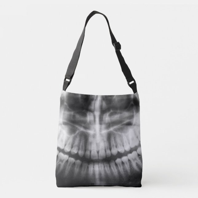 Bolsa Ajustável Dentes de Raio X Sorriem Preto e Branco (Verso)