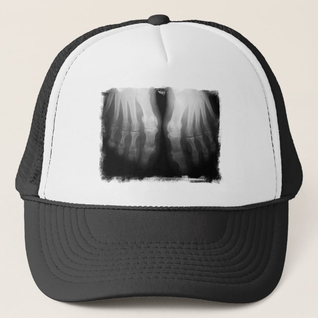 Boné Preto & branco de esqueleto humanos de ossos dos (Frente)