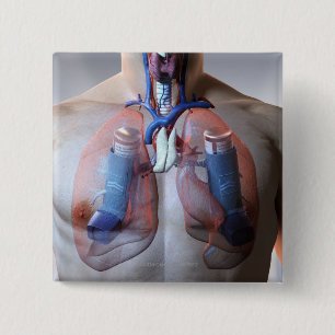 Bóton Quadrado 5.08cm Asma