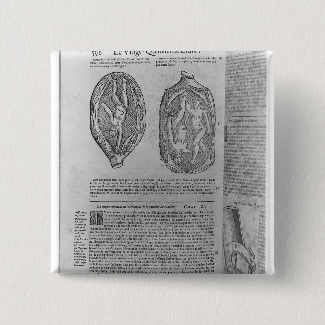 Bóton Quadrado 5.08cm Feto, ilustração 'das obras (Frente)