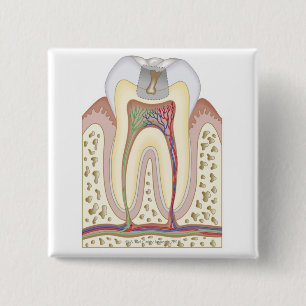 Bóton Quadrado 5.08cm Ilustração da deterioração de dente