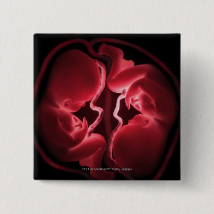 Bóton Quadrado 5.08cm Imagem conceptual de um ventre que contem gêmeos