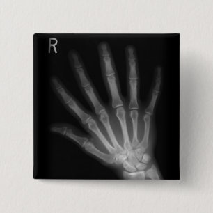 Bóton Quadrado 5.08cm Mão Direita de raio X Extra Digit