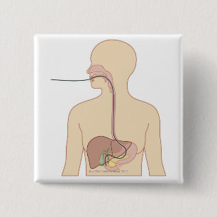 Bóton Quadrado 5.08cm Rota do endoscópio