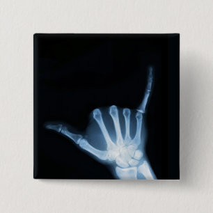 Bóton Quadrado 5.08cm Símbolo Shaka X-Ray (Hang Loose)