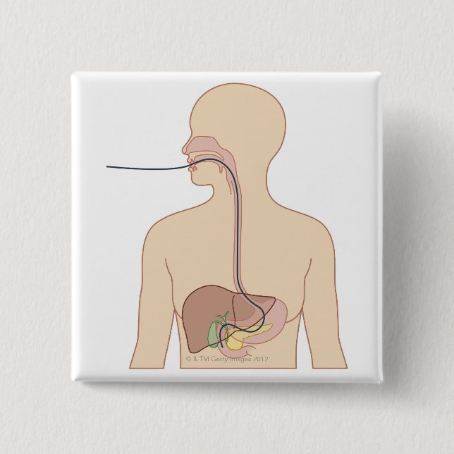 Bóton Quadrado 5.08cm Via de Endoscópio (Frente)