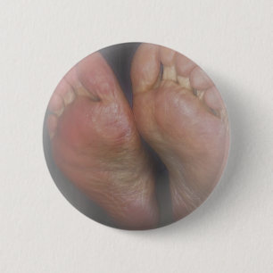 BÓTON REDONDO 5.08CM BOTÃO DE ALIMENTAÇÃO ÚNICA