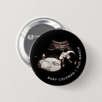 O anúncio de ultrassom de foto de bebê em breve