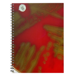 Caderno Espiral Bactérias de Penumonia