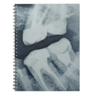 Caderno Espiral Fim-acima de um raio X dental