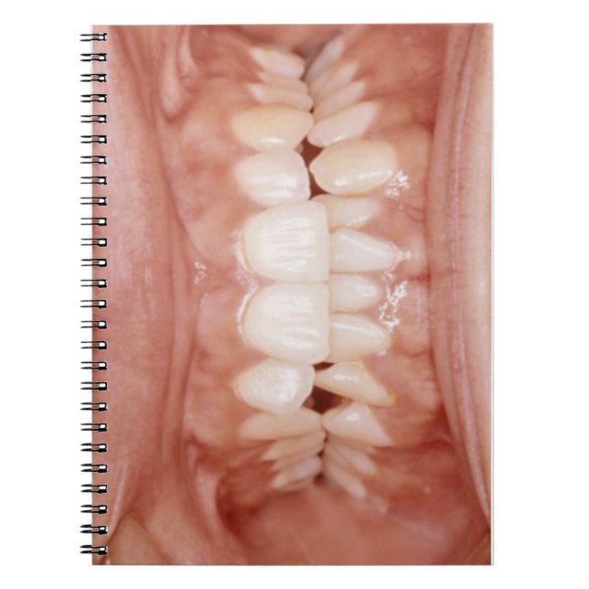 Caderno Espiral Foto cruento incomum estranha das gomas dos dentes (Frente)