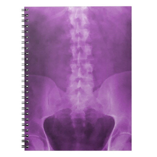 Caderno Espiral Notebook Roxo Digital X-Ray Art (Frente)