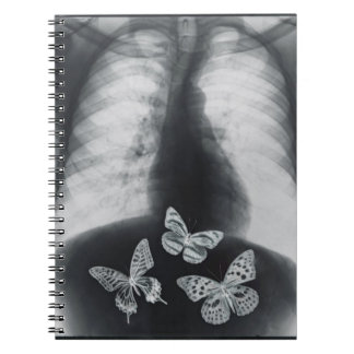 Caderno Espiral Raio X das borboletas no estômago