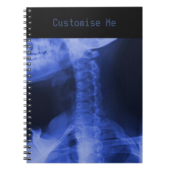 Caderno Espiral Raios X 2 - Azul eletromagnético (Frente)