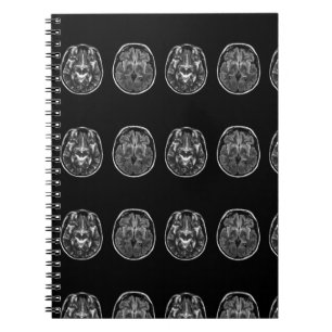 Caderno Espiral Scanner mri do cérebro
