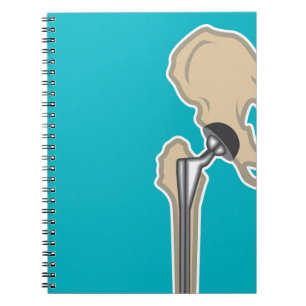 Caderno Espiral Substituição da articulação da bacia