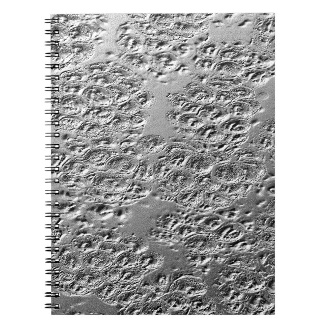 Caderno Espiral Tinta danificada (Frente)