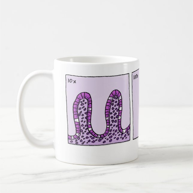 Café caneca de 1000x Immunohistochemistry (Esquerda)