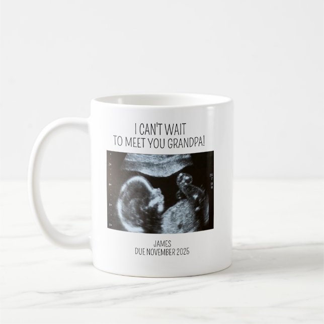 Café Caneca de Ultrassom, Ultrassom do Bebê, Presentes  (Esquerda)