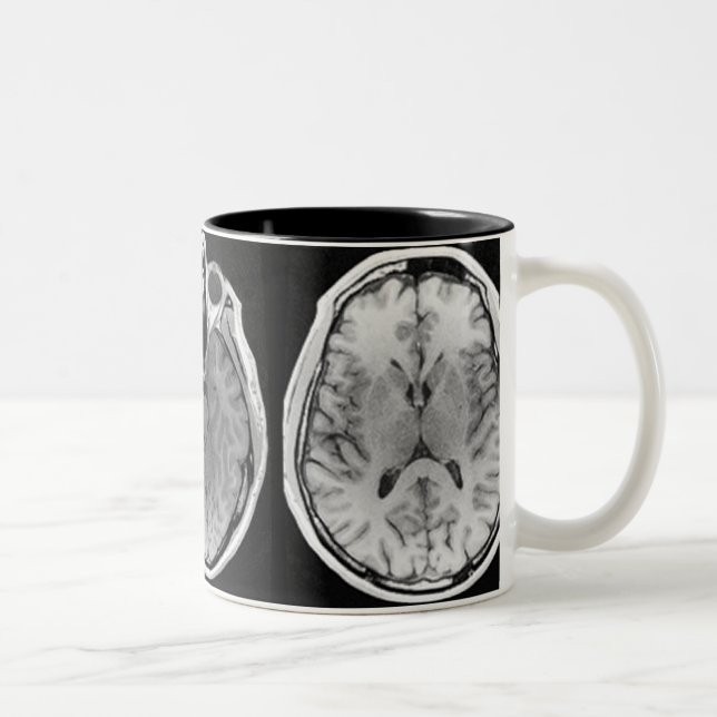 Café Em Dois Tons Caneca da imagem do cérebro de MRI (Direita)