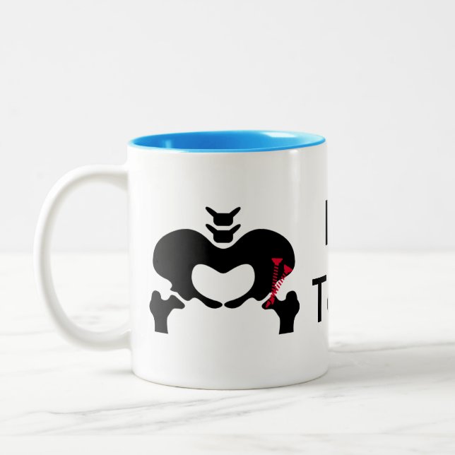 Café Em Dois Tons Osteotomy Peri-acetabular clássico da caneca de (Esquerda)