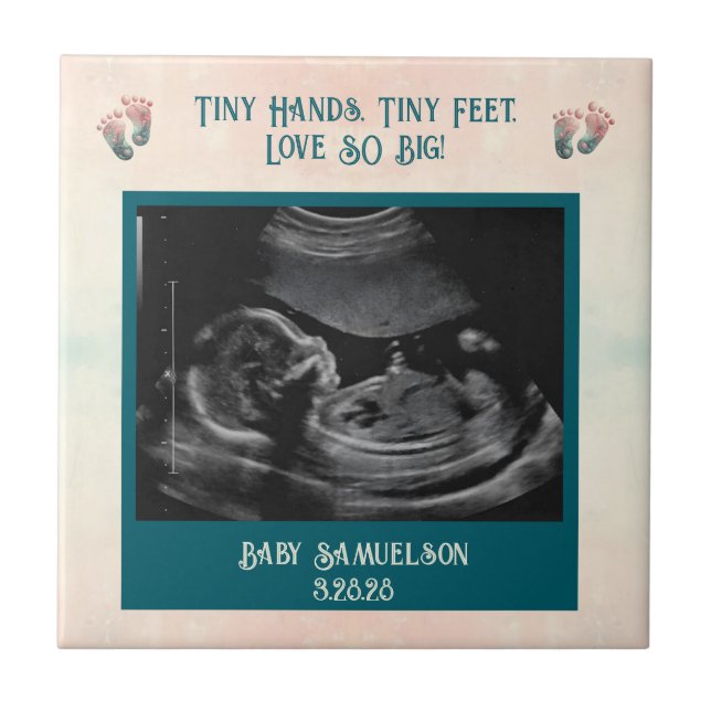 Caixa de Presente do Baby Ultrassom Keepsasaame (Frente)