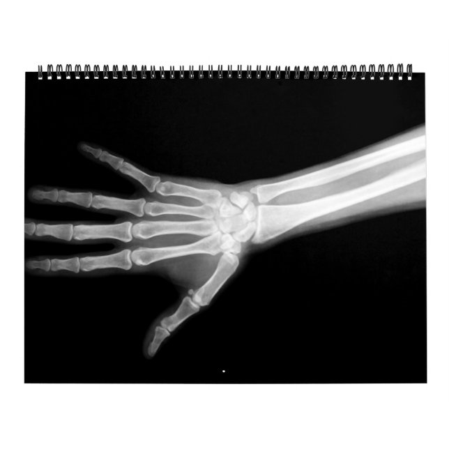 Calendário Esqueleto de Raio X Preto e Branco (Capa)