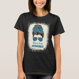 Camiseta Alopecia Areata Sensibilização Pão Penteado Pentea