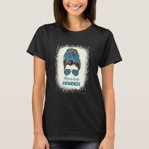 Camiseta Alopecia Areata Sensibilização Pão Penteado Pentea