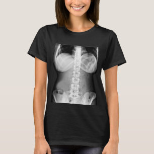 Camiseta Anatomia do Corpo Feminino Raio X Foto Esqueleto H