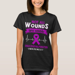 Camiseta Arnold Chiari Malformação Nem Todas As Feridas São