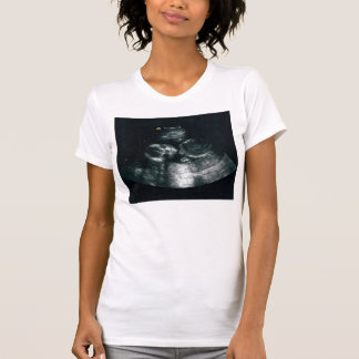 Camiseta Bebê para dentro