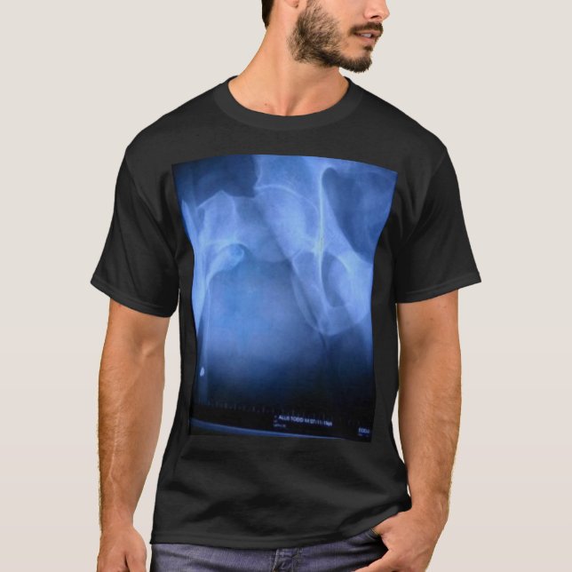 Camiseta fémur quebrado (Frente)