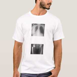 Camiseta Meu quadril apenas rachado do sadness.