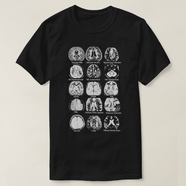 Camiseta Neurologia Cérebro Dvhh Pml (Frente do Design)