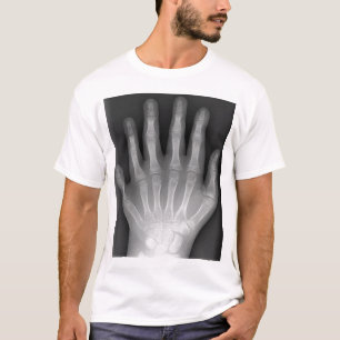 Camiseta Polydactyly, seis mãos apontado, raio X, raridade!