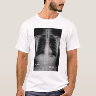 Camiseta “Retro VHS X-Ray” Raio-X de tórax retrô com VHS