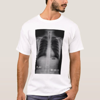 Camiseta “Retro VHS X-Ray” Raio-X de tórax retrô com VHS 