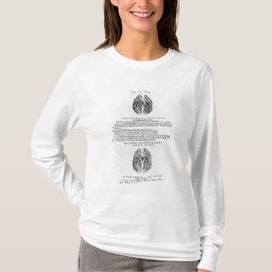 Camiseta Sistema vascular do cérebro
