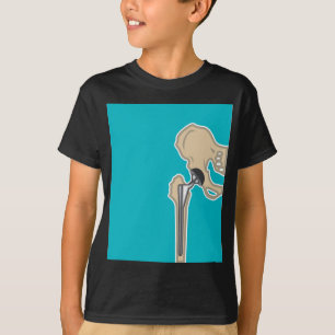 Camiseta Substituição da articulação da bacia