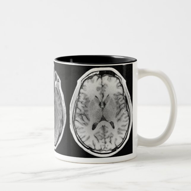 Caneca da imagem do cérebro de MRI (Direita)