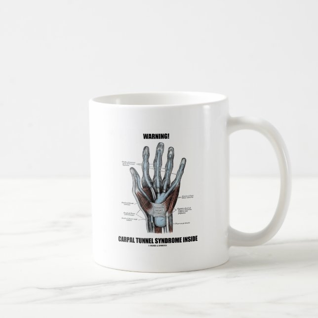 Caneca De Café Aviso! Síndrome do Túnel Carpal Dentro (Anatomia) (Direita)