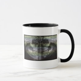 Caneca de café de OPG