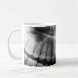 Caneca De Café Dentes de Raio X Sorriso de Boca Preto e Branco