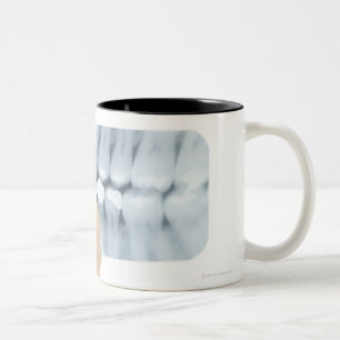 Caneca De Café Em Dois Tons MODELO LIBERADO. Raio X dental