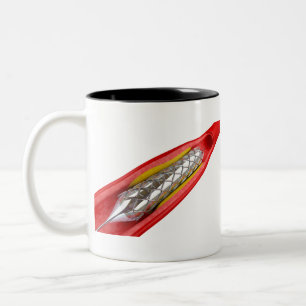 Caneca De Café Em Dois Tons Procedimento de angioplastia