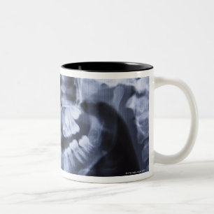 Caneca De Café Em Dois Tons Raio X de um jawline das meninas tomado com um