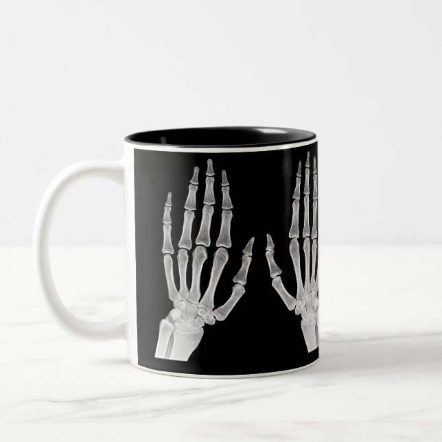 Caneca De Café Em Dois Tons Skeleton Hands Xray Picture Human Anatomy photo (Esquerda)