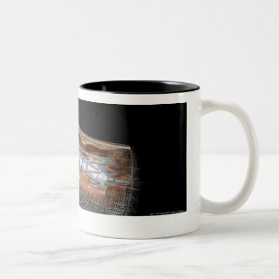 Caneca De Café Em Dois Tons Vista de um balão angioplaty em uma artéria